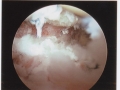 my surgery 023